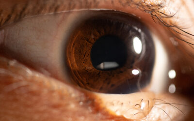 Trockene Augen im Arbeitsalltag: Tränenfilm, Klima, Monitor – ein Praxisleitfaden